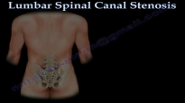 Lumbar Spinal Canal Stenosis, lowback pain  Everything You Need To Know  Dr. Nabil Ebraheim