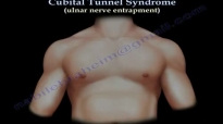 Cubital Tunnel Syndrome Ulnar Nerve Entrapment  Everything You Need To Know  Dr. Nabil Ebraheim