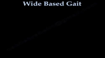 Wide Based Gait, Myelopathy Gait  Everything You Need To Know  Dr. Nabil Ebraheim