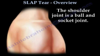 SLAP Tear Overview  Everything You Need To Know  Dr. Nabil Ebraheim