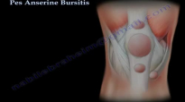 Pes Anserine Bursitis , knee pain  Everything You Need To Know  Dr. Nabil Ebraheim