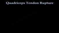 Quadriceps Tendon Rupture  Everything You Need To Know  Nabil Ebraheim