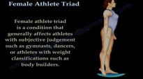 Female Athlete Triad  Everything You Need To Know  Dr. Nabil Ebraheim