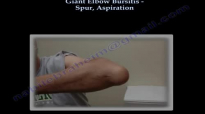Elbow Bursitis Giant , Aspiration, Spur  Everything You Need To Know  Dr. Nabil Ebraheim