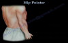 Hip Pointer  Everything You Need To Know  Dr. Nabil Ebraheim