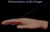 Dislocations Of The Finger  Everything You Need To Know  Dr. Nabil Ebraheim