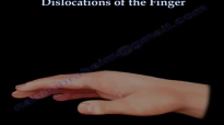 Dislocations Of The Finger  Everything You Need To Know  Dr. Nabil Ebraheim