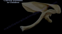 Clavicle Fractures In Children  Everything You Need To Know  Dr. Nabil Ebraheim