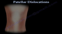 Patellar Dislocations  Everything You Need To Know  Dr. Nabil Ebraheim