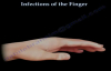 Infections Of The Finger  Everything You Need To Know  Dr. Nabil Ebraheim