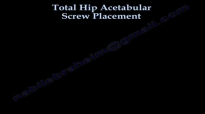 Total Hip Acetabular Screw Placement  Everything You Need To Know  Dr. Nabil Ebraheim