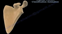 Scapular Fracture Classification Animation  Everything You Need To Know  Dr. Nabil Ebraheim