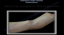 Extensor Carpi Ulnaris Subluxation  Everything You Need To Know  Dr. Nabil Ebraheim