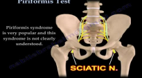 Piriformis Test , Piriformis Syndrome  Everything You Need To Know  Dr. Nabil Ebraheim
