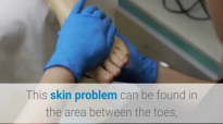 10 Home Remedies For Athlete's Foot.mp4