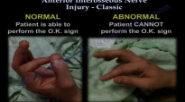 Anterior Interosseous Nerve Injury Classic  Everything You Need To Know  Dr. Nabil Ebraheim