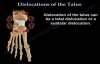 Dislocations Of The Talus  Everything You Need To Know  Dr. Nabil Ebraheim