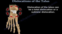 Dislocations Of The Talus  Everything You Need To Know  Dr. Nabil Ebraheim