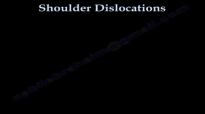 Shoulder Dislocations  Everything You Need To Know  Dr. Nabil Ebraheim