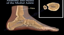 Anatomy and injuries of The Medial Ankle  Everything You Need To Know  Dr. Nabil Ebraheim