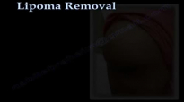 shoulder Lipoma, fatty tumor  Everything You Need To Know  Dr. Nabil Ebraheim