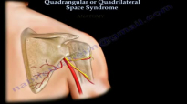 Quadrangular Or Quadrilateral Space Syndrome  Everything You Need To Know  Dr. Nabil E