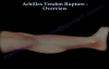Achilles Tendon Rupture Overview  Everything You Need To Know  Dr. Nabil Ebraheim