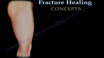 Fracture Healing Part 1  Everything You Need To Know  Dr. Nabil Ebraheim