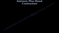 Intrinsic Plus Hand Contracture  Everything You Need To Know  Dr. Nabil Ebraheim