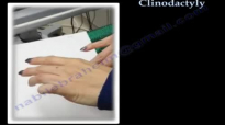 Clinodactly  Everything You Need To Know  Dr. Nabil Ebraheim