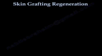 Skin Grafting Regeneration  Everything You Need To Know  Dr. Nabil Ebraheim
