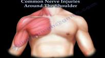 Shoulder Nerve injury ,Injuries  Everything You Need To Know  Dr. Nabil Ebraheim