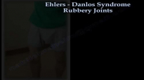 Elhers  Danlos Syndrome Rubbery Joints  Everything You Need To Know  Dr. Nabil Ebraheim