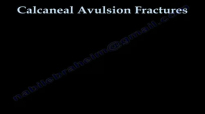 CALCANEAL AVULSION FRACTURES ,heel bone injury  Everything You Need To Know  Dr. Nabil Ebraheim