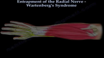 Entrapment of Radial Nerve, Wartenbergs Syndrome  Everything You Need To Know  Dr. Nabil Ebraheim
