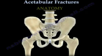 Acetabular Fractures  Everything You Need To Know  Dr. Nabil Ebraheim