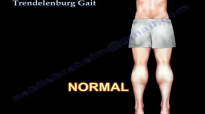 Trendelenburg Gait  Everything You Need To Know  Dr. Nabil Ebraheim