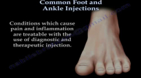 Common Foot And Ankle Injections  Everything You Need To Know  Dr. Nabil Ebraheim