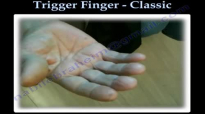 Trigger Finger Classic  Everything You Need To Know  Dr. Nabil Ebraheim