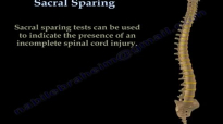Sacral Sparing  Everything You Need To Know  Dr. Nabil Ebraheim