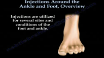 Injections Around The Ankle and Foot Overview  Everything You Need To Know  Dr. Nabil Ebraheim