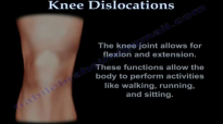 Knee Dislocations  Everything You Need To Know  Dr. Nabil Ebraheim