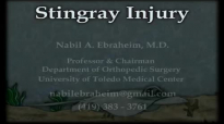 Stingray fish injury  Everything You Need To Know  Dr. Nabil Ebraheim